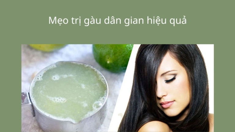 Bí kíp review cách trị gàu tận gốc hiệu quả sau 7 ngày ngay