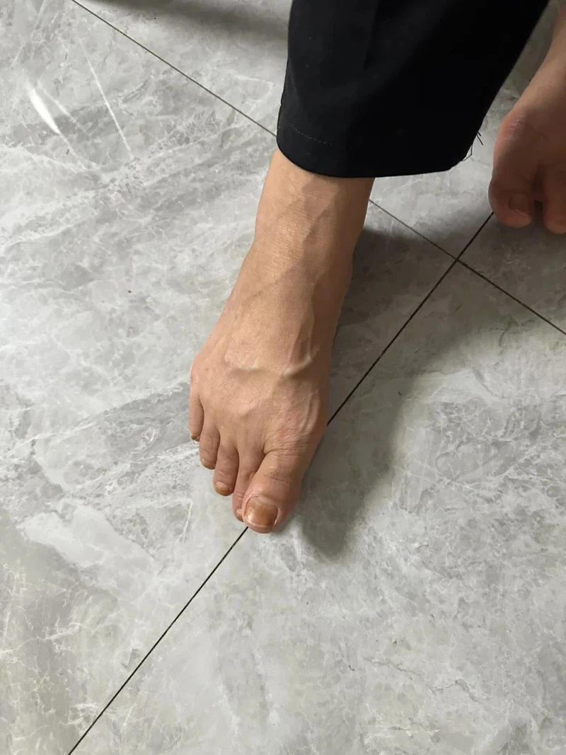 Hướng dẫn an toàn cách hết chuột rút khi mang thai dễ áp dụng