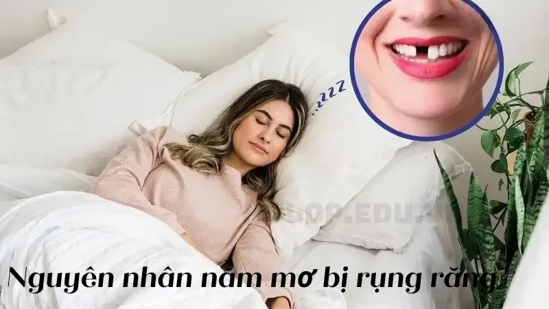Nguyên nhân nằm mơ bị rụng răng